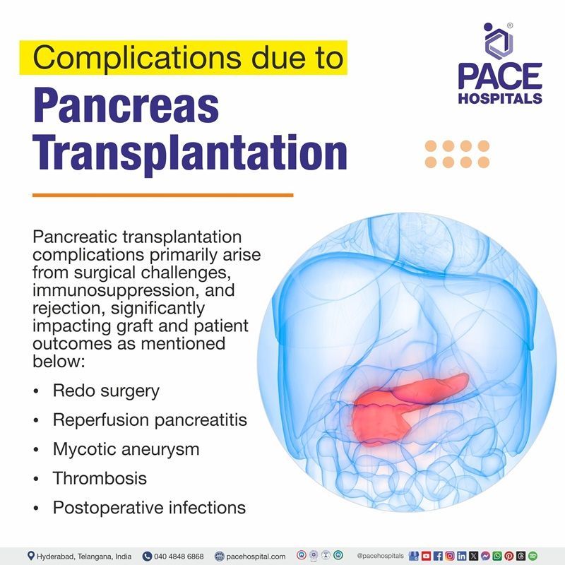 Pancreas transplant complications pancreas transplant complications | image displaying the complications of Pancreas transplant