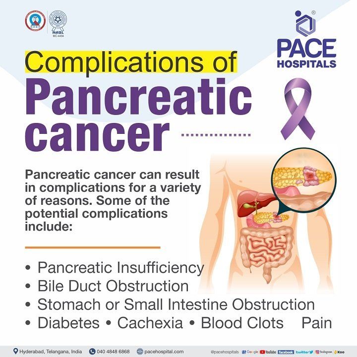 pancreatic cancer complications complications of pancreatic cancer