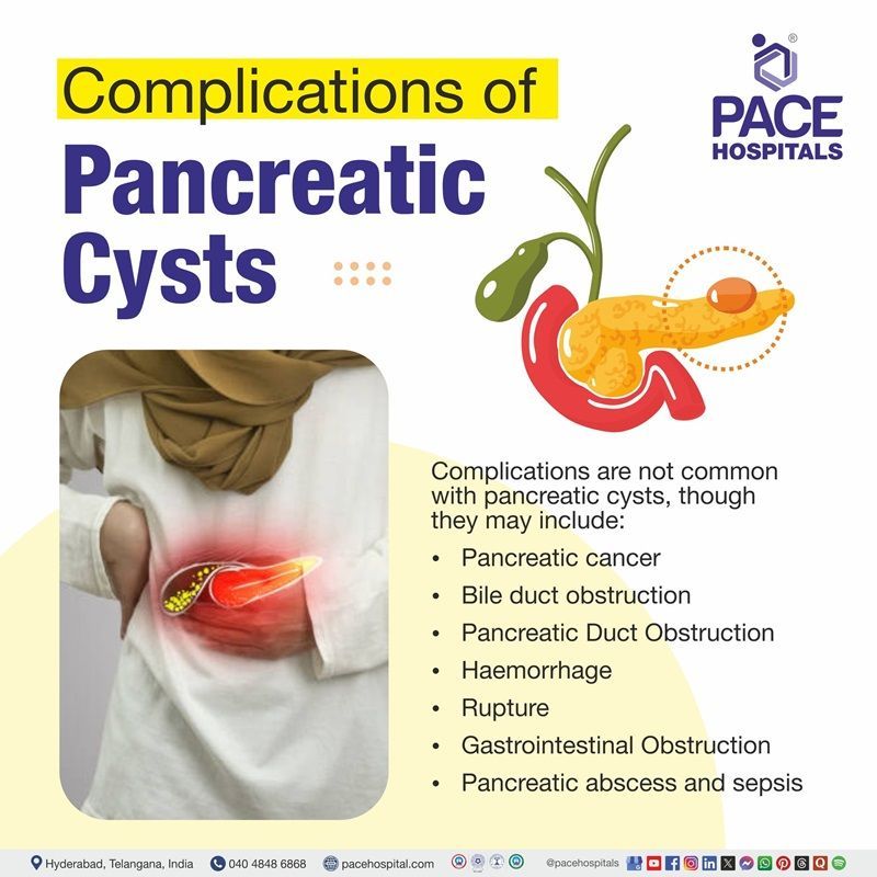 Pancreatic Cyst Complications Pancreatic Cyst Complications | visual showing the complications of Pancreatic Cyst