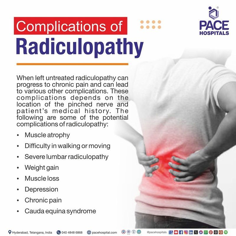 Complications of cervical radiculopathy​ | complications of lumbar radiculopathy​