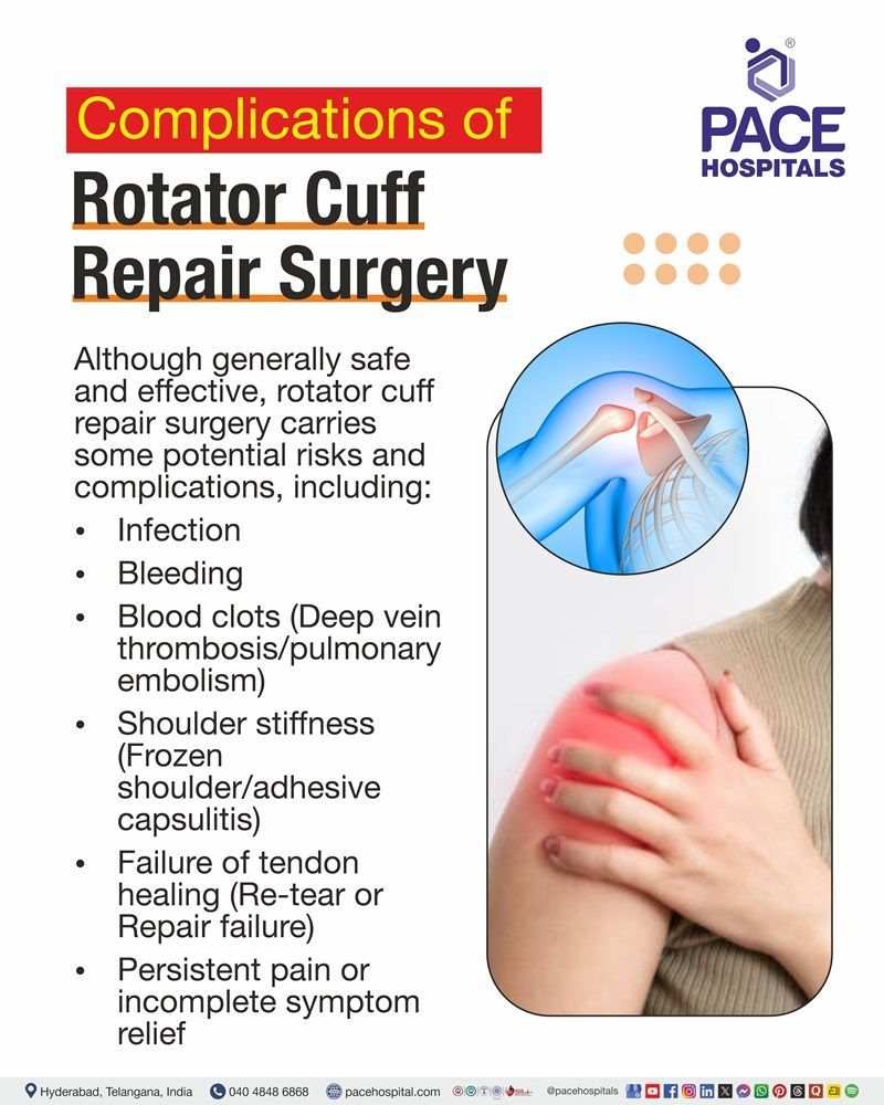 Complications of Rotator Cuff Repair Surgery Visual representation of potential complications following rotator cuff repair surgery, including shoulder stiffness, tendon re-tear, and persistent pain.