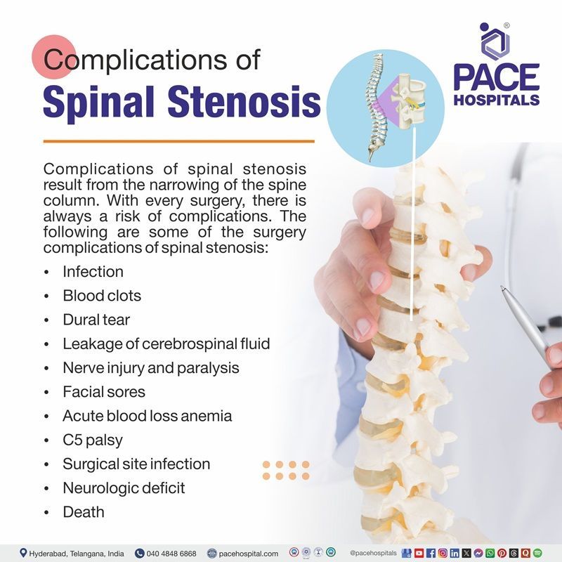 Complications of Spinal Stenosis | Spinal Stenosis Complications