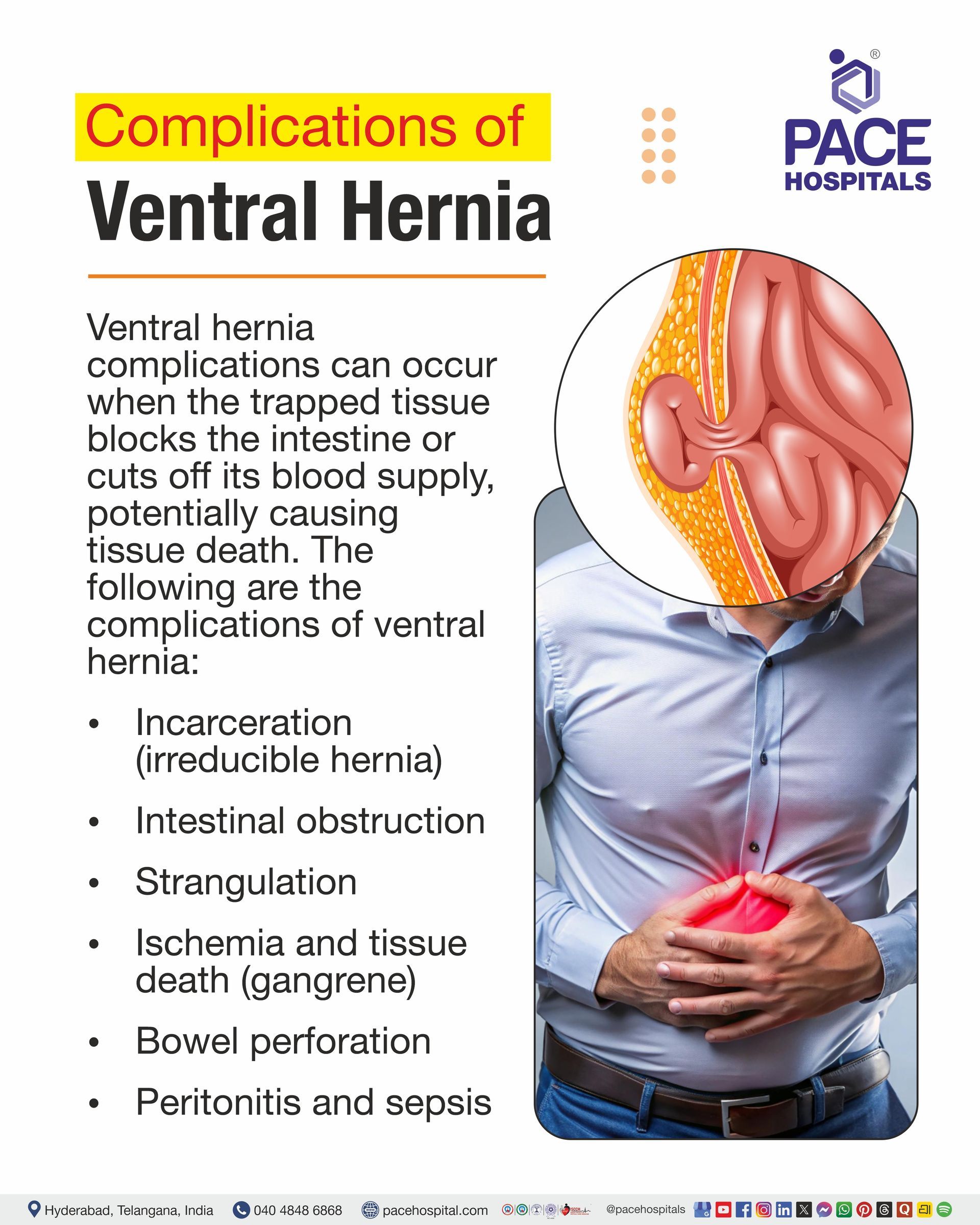 Complications of Ventral Hernia ventral hernia complications I ventral hernia repair complications I post ventral hernia repair complications