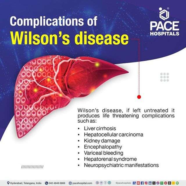 Wilson's Disease