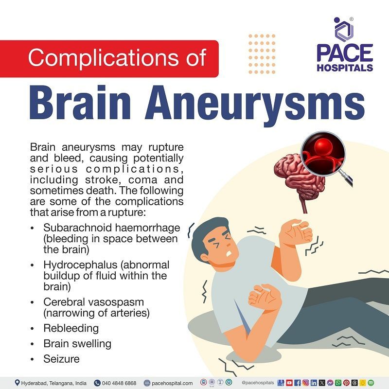 Complications of Brain aneurysm complications of Brain aneurysm | Brain aneurysm complications | what are the complications of Brain aneurysm
