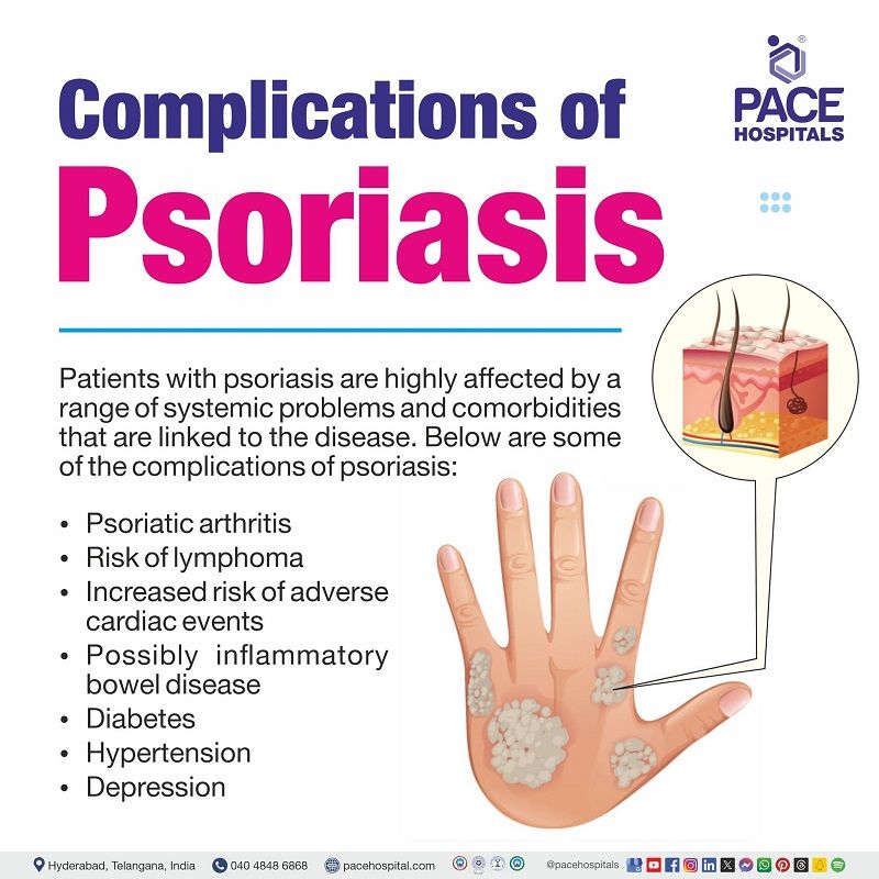 Complications of Psoriasis Psoriasis complications | complications of pustular psoriasis | What are the complications of Psoriasis | Psoriasis and its complications | Visual outlining the complications of Psoriasis