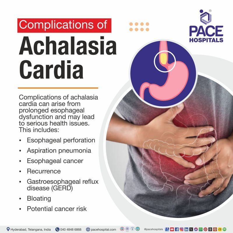 Achalasia Cardia Complications | Complications of Achalasia Cardia