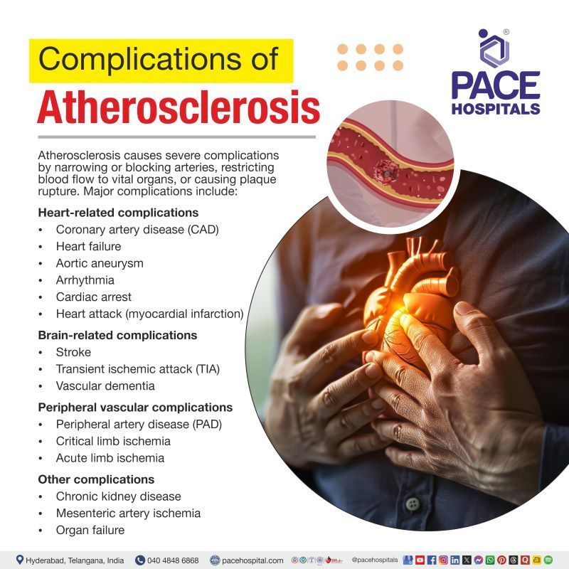 Complications of Atherosclerosis Complications of atherosclerosis | Atherosclerosis complications