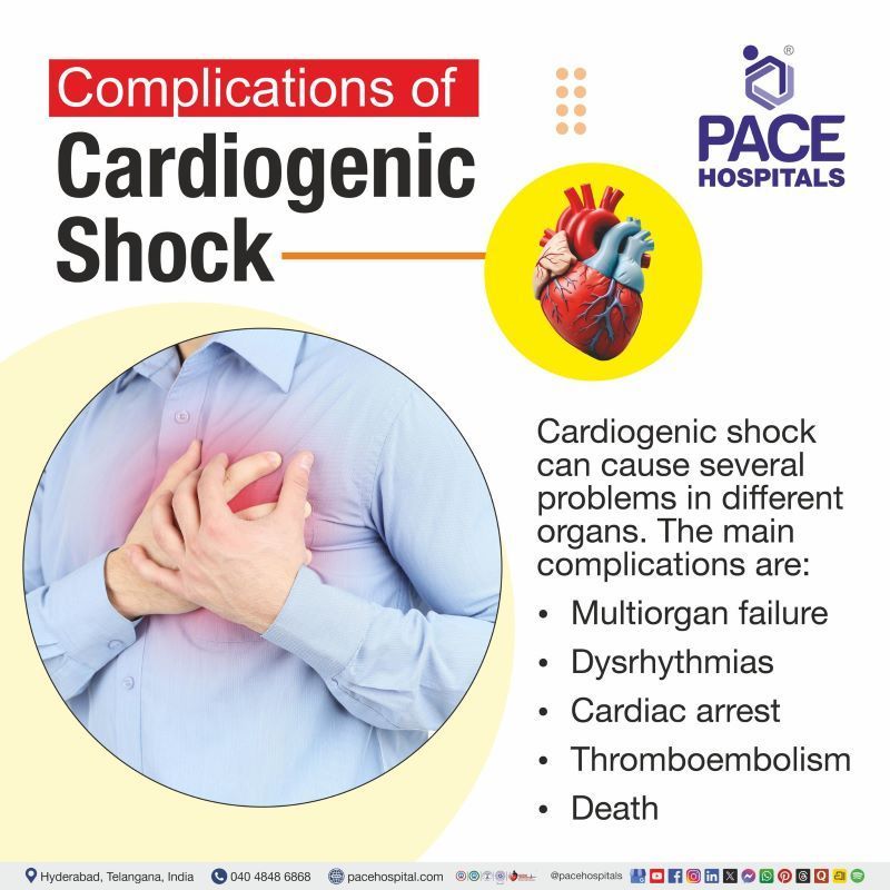 Complications of Cardiogenic Shock Complications of Cardiogenic Shock | Cardiogenic Shock Complications