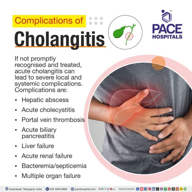 Complications of Cholangitis Cholangitis Complications | Complications of Cholangitis