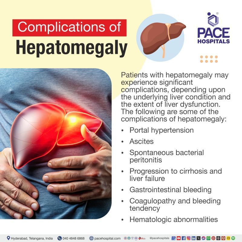 Complications of Hepatomegaly Complications of Hepatomegaly | Hepatomegaly Complications