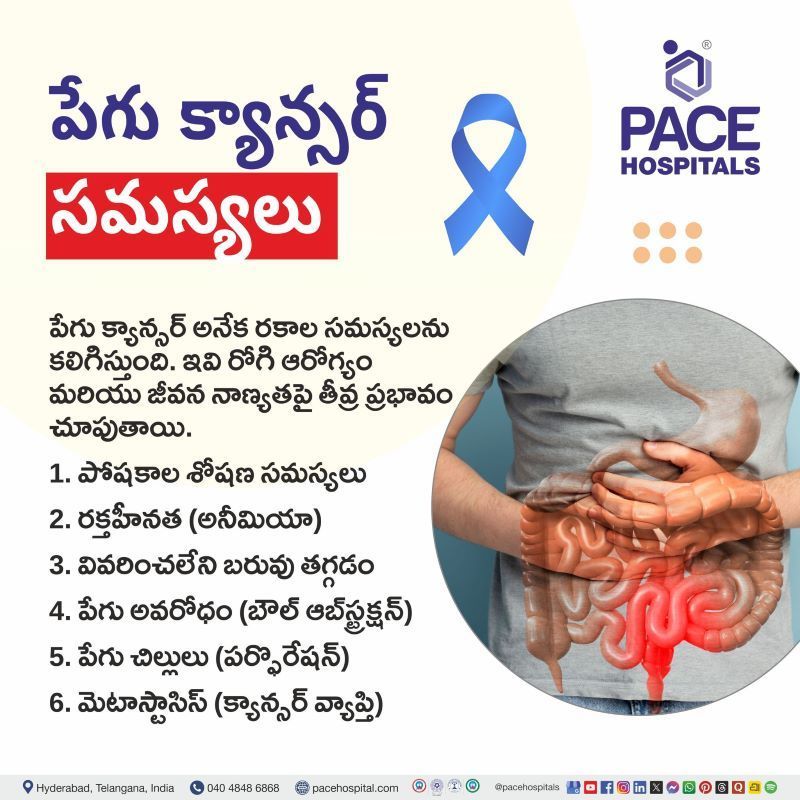 పేగు క్యాన్సర్ సమస్యలు | Complications of Intestinal Cancer in Telugu Complications of Intestinal Cancer in Telugu | పేగు క్యాన్సర్ సమస్యలు | Intestinal Cancer Complications in Telugu