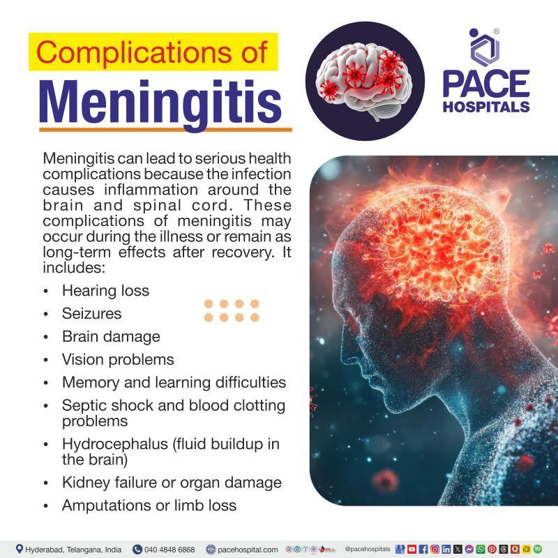 Complications of Meningitis Complications of Meningitis | Complications for Meningitis | Post meningitis complications