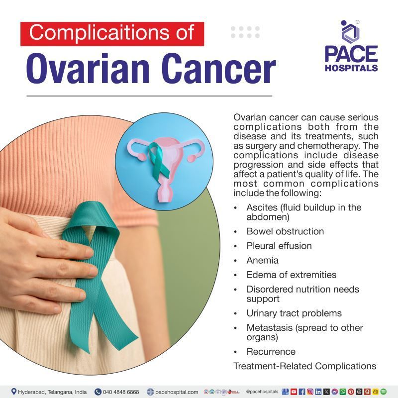Complications of Ovarian Cancer Complications of Ovarian Cancer | Ovarian Cancer Complications
