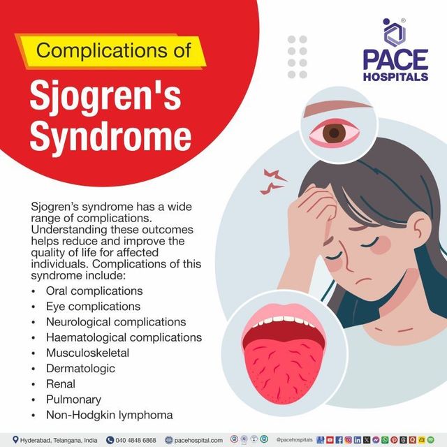 Sjogren's Syndrome: Symptoms, Causes, Diagnosis & Treatment