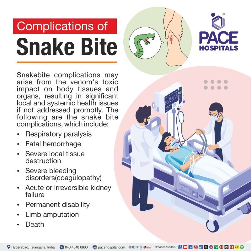 Complications of Snake Bite Complications of Snake Bite | Snake Bite complications