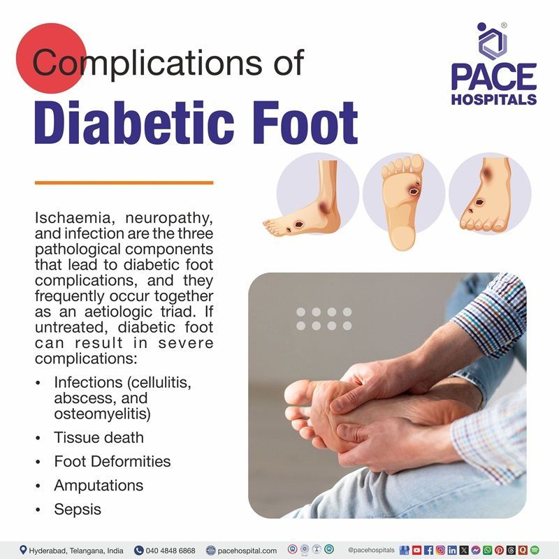 Diabetic Foot Complications Complications of diabetic foot infection | Visual depicting diabetic foot complications