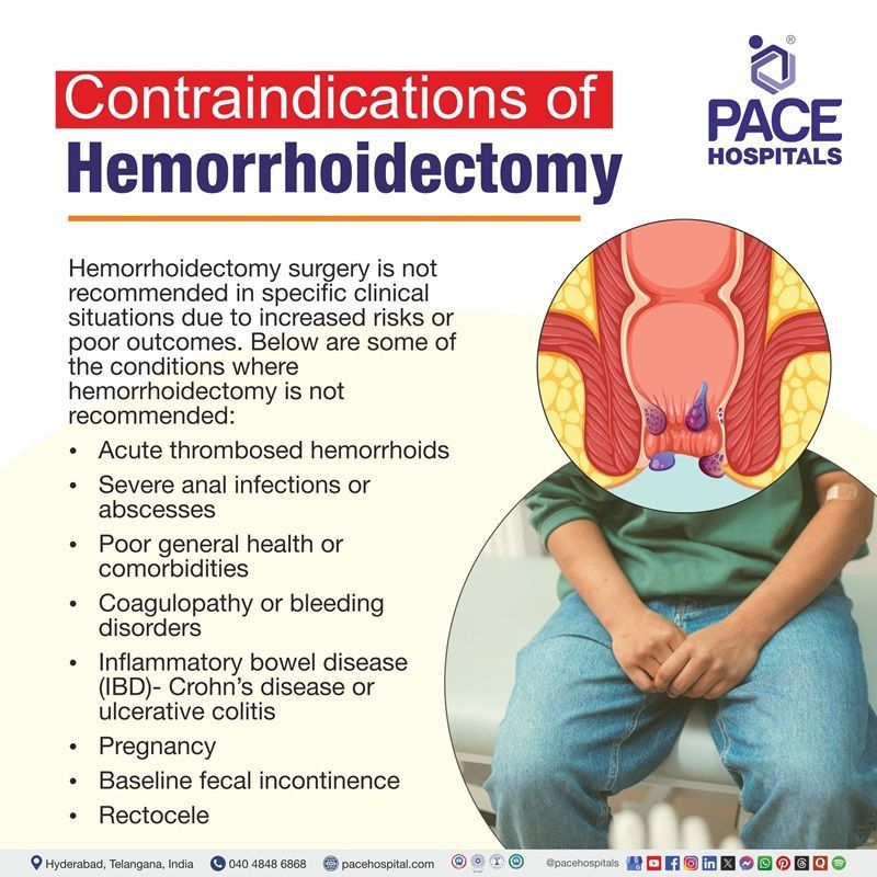 Contraindications of hemorrhoidectomy hemorrhoidectomy Contraindications | Contraindications of hemorrhoidectomy | What are the Contraindications of hemorrhoidectomy
