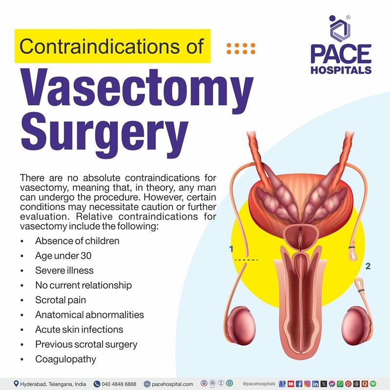 Contraindications of Vasectomy Surgery | Vasectomy Surgery Contraindications
