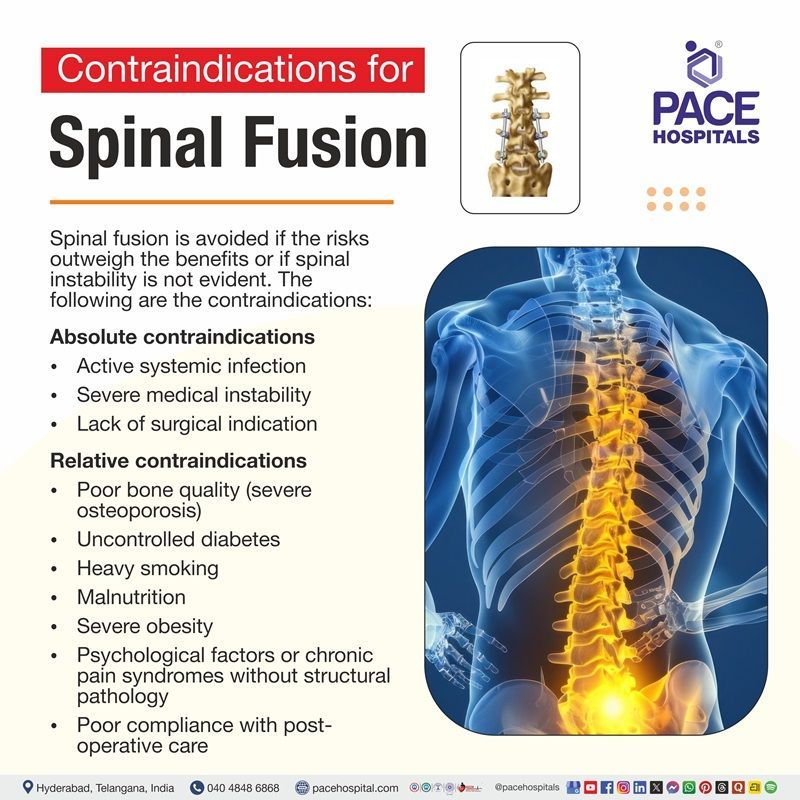 Contraindications of Spinal Fusion Surgery image depicting the contraindications of Spinal Fusion Surgery | Spinal Fusion Contraindications