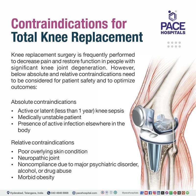 Contraindications for Total Knee Replacement Surgery Contraindications for Total Knee Replacement | Best Knee Replacement Hospital in Hyderabad, Telangana, India