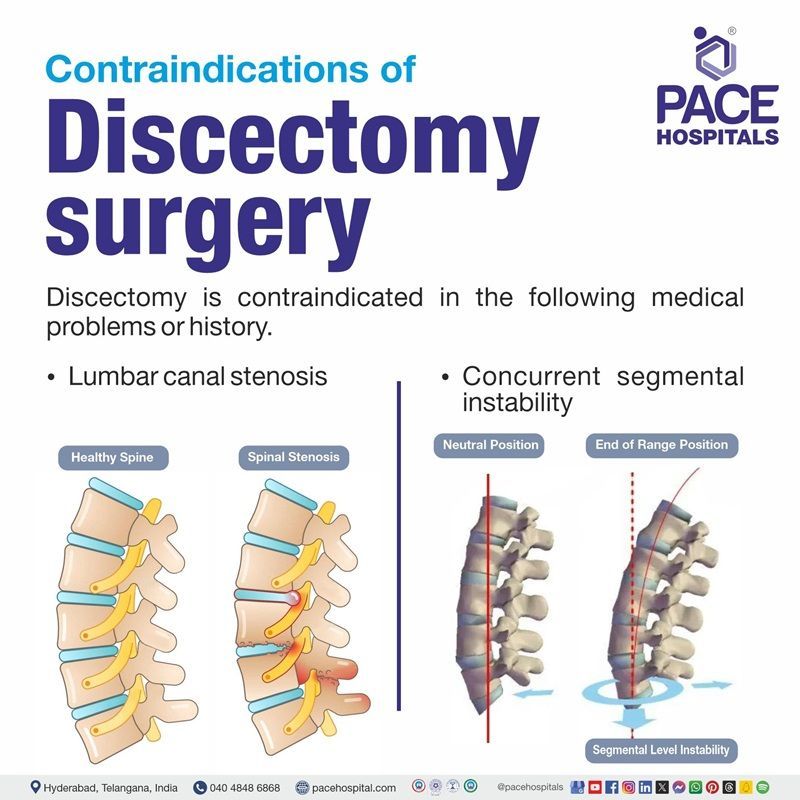 Discectomy contraindications Contraindications of Discectomy surgery or procedure