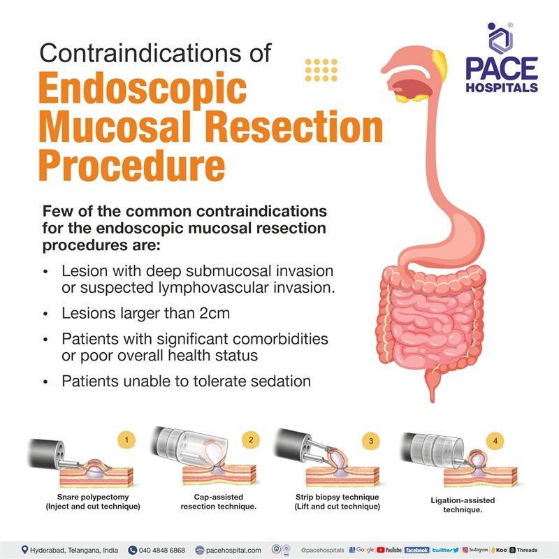 endoscopic mucosal resection technique contraindications endoscopic mucosal resection technique | endoscopic mucosal resection vs polypectomy | endoscopic mucosal resection near me | endoscopic mucosal resection contraindications