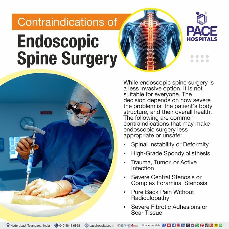 Contraindications of Endoscopic spine surgery Contraindications of endoscopic spine surgery with surgeon and spine image | Endoscopic spine surgery contraindications
