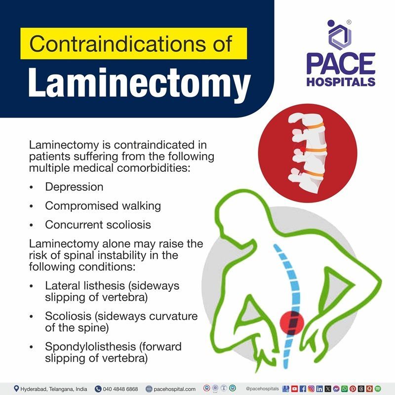 Contraindications of laminectomy Laminectomy contraindications | Visual depicting the contraindications of laminectomy