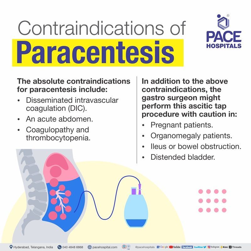 ascites tapping - paracentesis contraindications paracentesis contraindications | ascitic tapping contraindication | ascites tapping procedure contraindications