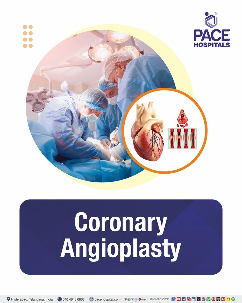 Coronary Angioplasty Cost in Hyderabad | Affordable Coronary in India