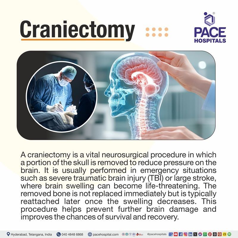 What is a craniectomy​y | craniectomy Procedure | decompressive craniectomy​