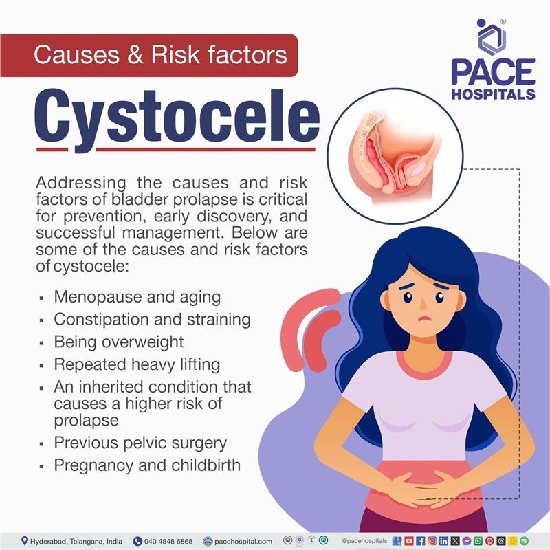 Causes and Risk factors of Cystocele cystocele causes | what causes cystocele | Risk factors of Cystocele | Cystocele risk factors | Visual narrating the causes and Risk factors of Cystocele