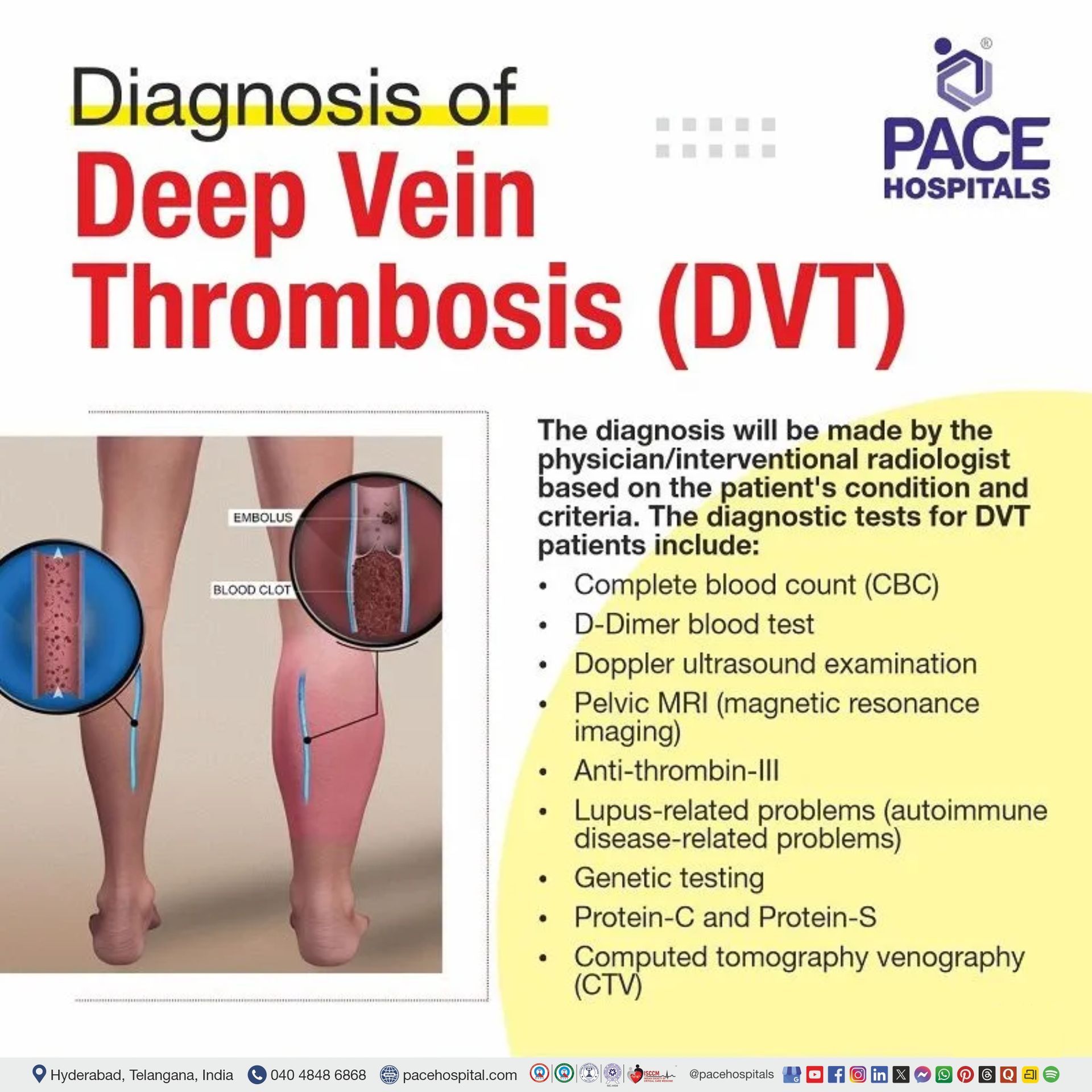 Diagnosis of DVT - Deep Vein Thrombosis dvt diagnosis in hyderabad | dvt diagnostic test | deep vein thrombosis diagnosis | early diagnosis on deep vein thrombosis | diagnosis of dvt and pe in India