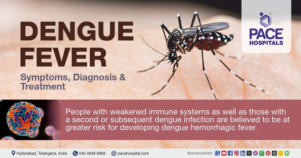 Dengue Fever Symptoms, Causes, Diagnosis and Treatment