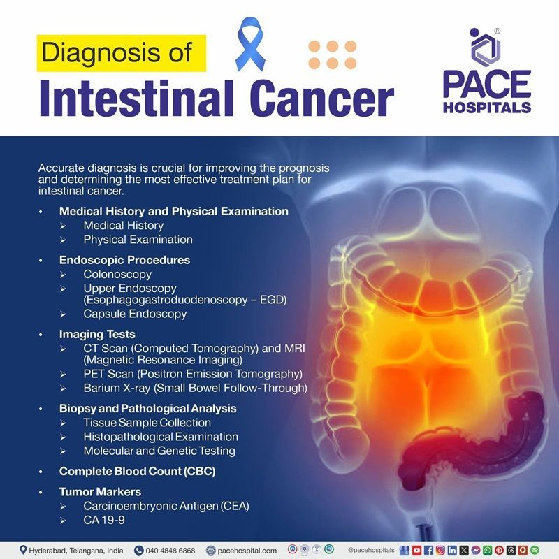 Intestinal cancer diagnosis Intestinal cancer diagnosis | visual depicting the list of intestinal cancer diagnosis ways