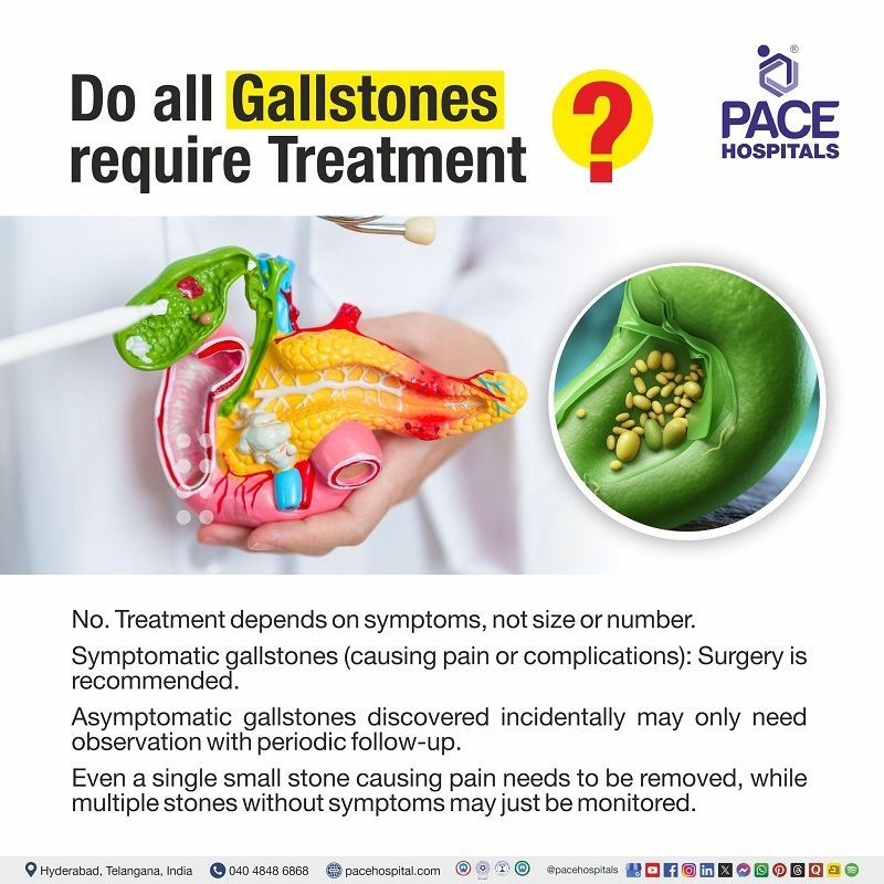 All Gallstones requires Treatment