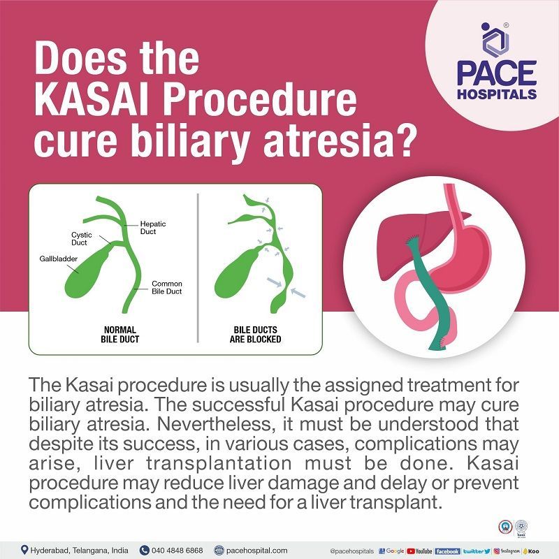 Can Kasai procedure cure biliary atresia? does the Kasai procedure cure biliary atresia | kasai procedure meaning in english | kasai procedure cost