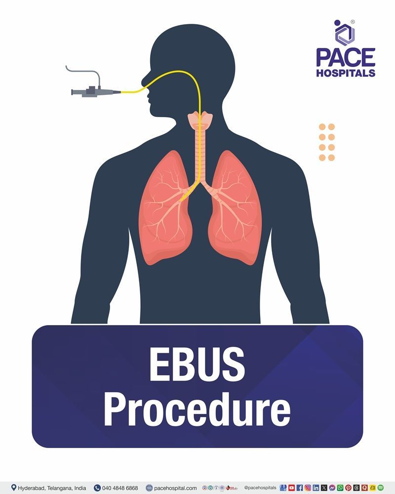 EBUS Procedure Cost in Hyderabad | Affordable Endobronchial Ultrasound Procedure in India