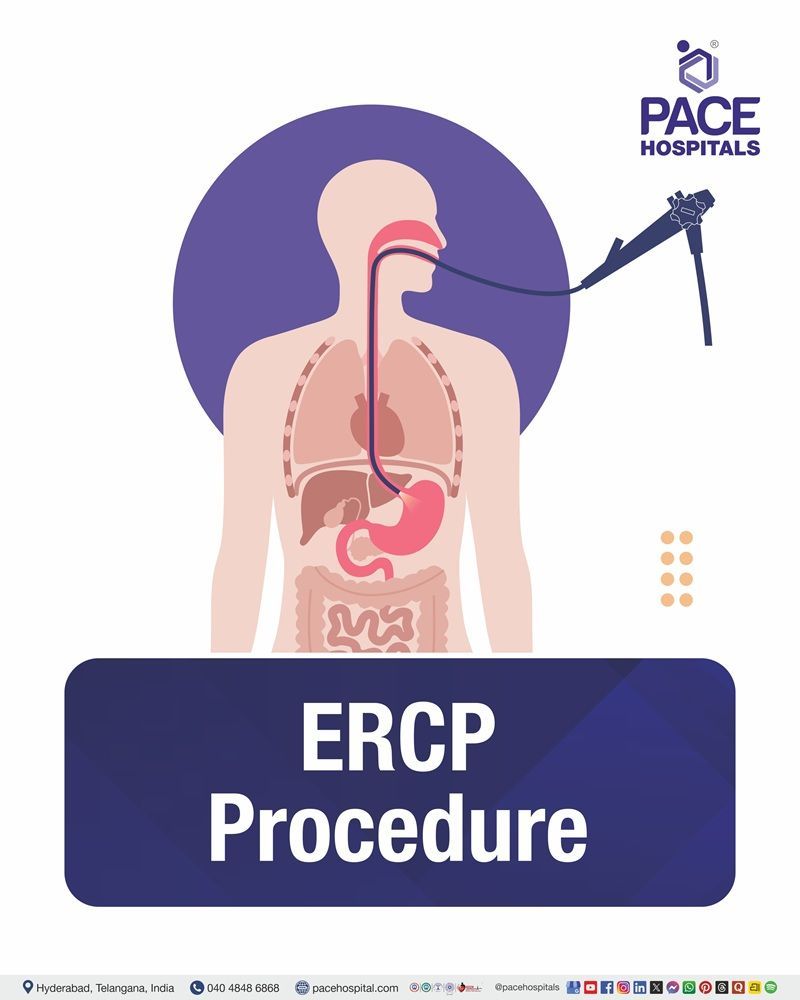 ERCP Procedure Cost in Hyderabad | Affordable ERCP Surgery in India