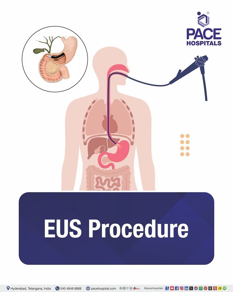 EUS Test Cost in Hyderabad | Affordable Endoscopic Ultrasound in Hyderabad