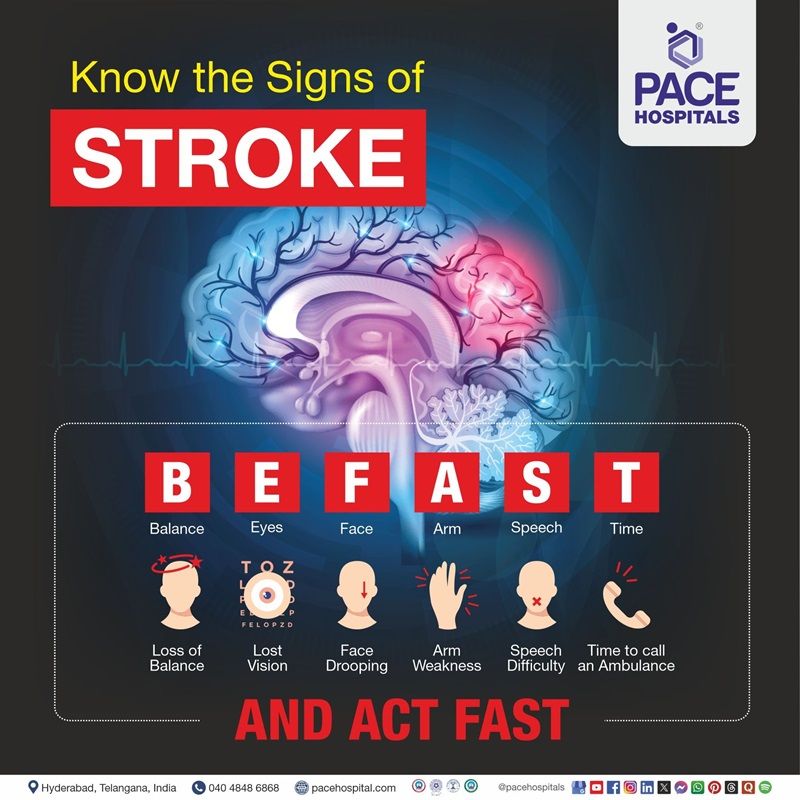Early signs & symptoms of Brain Stroke Early signs & symptoms of Brain Stroke | Best Treatment for Brain Stroke in Hyderabad, India | Treatment for Stroke in Brain