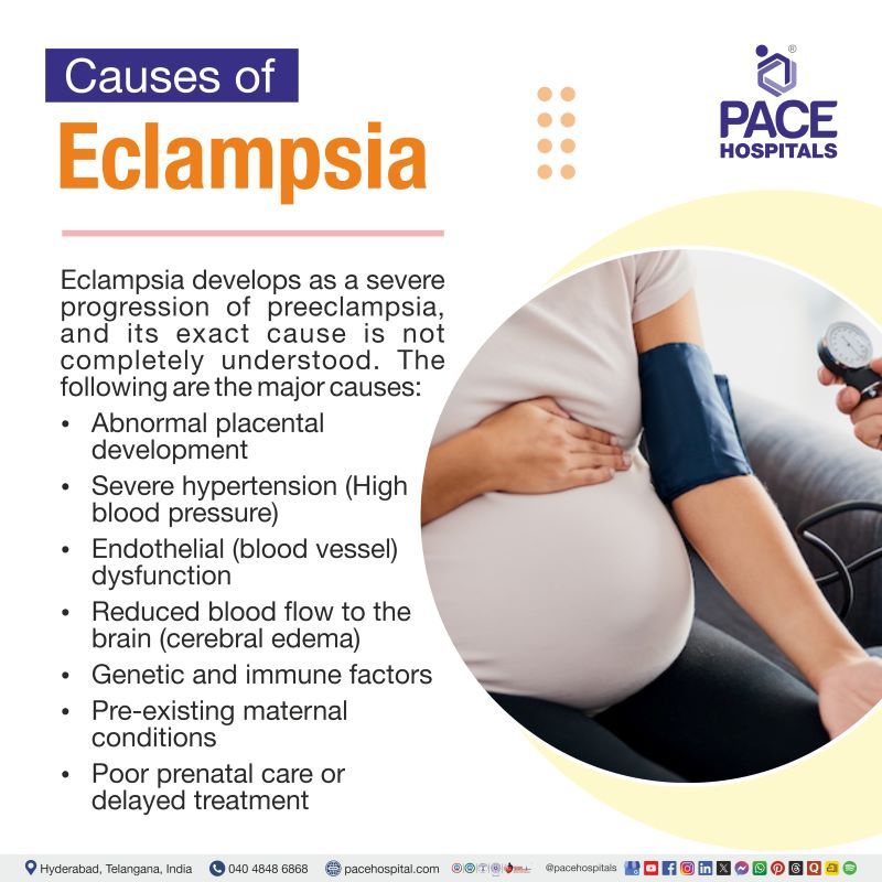 Eclampsia Causes Eclampsia Causes | What causes eclampsia | Causes of eclampsia