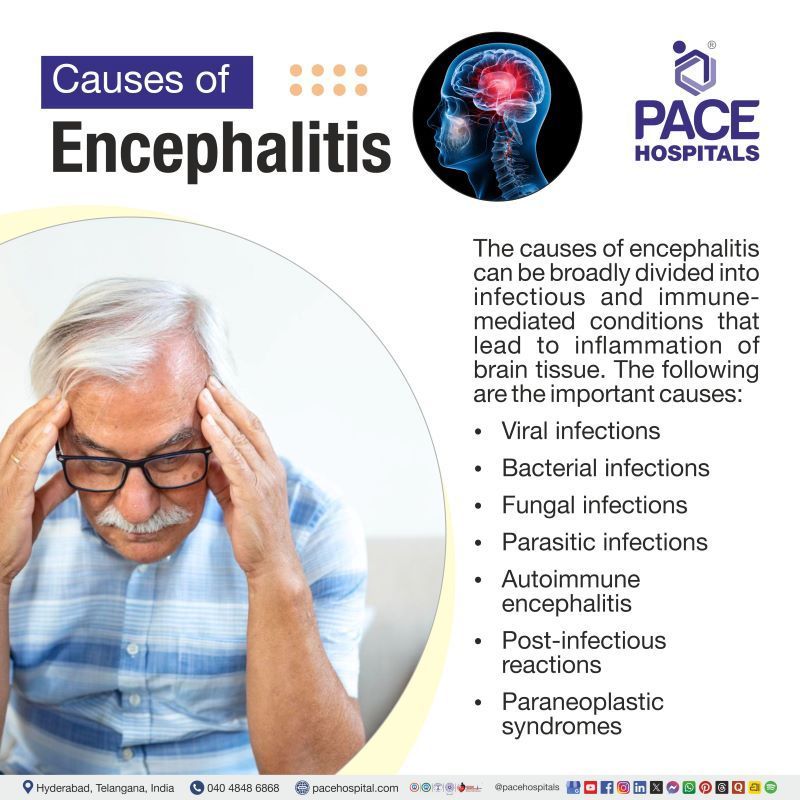Encephalitis Causes Encephalitis Causes | Causes of encephalitis | What causes Encephalitis