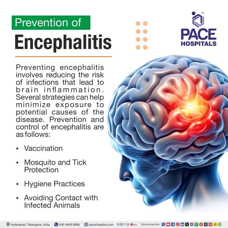 Encephalitis Prevention Encephalitis Prevention | Prevention and control of encephalitis | Encephalitis prevention measures