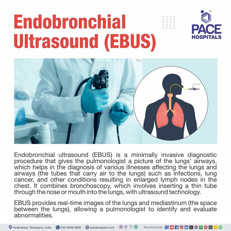 Endobronchial ultrasound - EBUS test endobronchial ultrasound cost in Hyderabad | endobronchial ultrasound biopsy in Hyderabad | Endobronchial ultrasound for lung conditions, lung cancer | benefits of endobronchial ultrasound