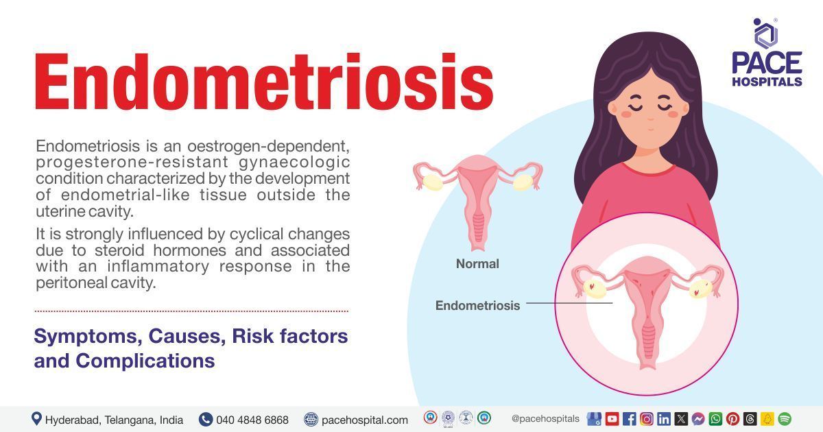 Endometriosis | Endometriosis symptoms | Endometriosis causes | Endometriosis treatment in India