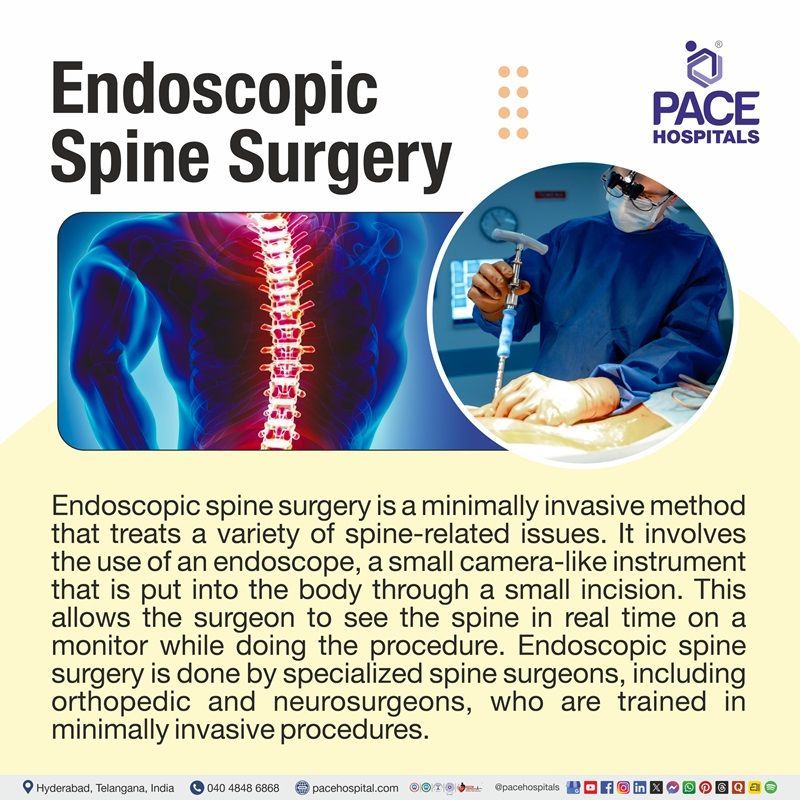 What is Endoscopic Spine Surgery? what is endoscopic spine surgery | endoscopic spine surgery meaning