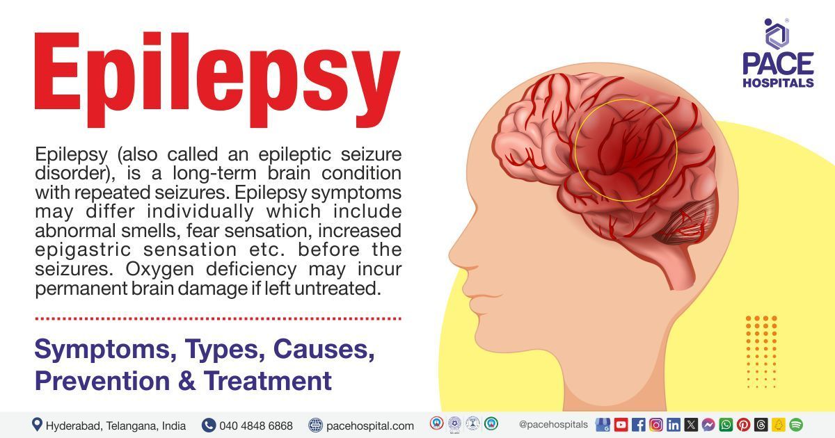 Explore everything about Epilepsy | Epilepsy types, symptoms & causes, Epilepsy treatment in India