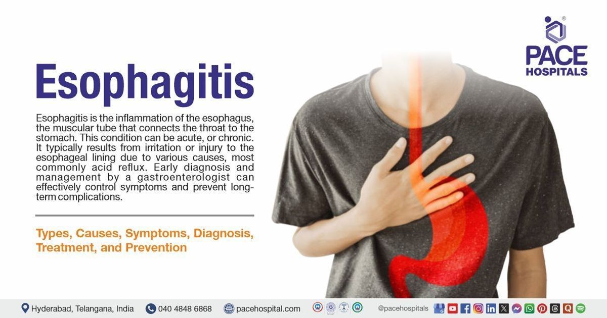 esophagitis symptoms | lifestyle changes to prevent esophagitis | Esophagitis treatment options
